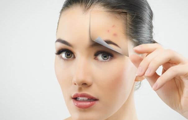 10 Ways to Get Rid of Pimples Overnight