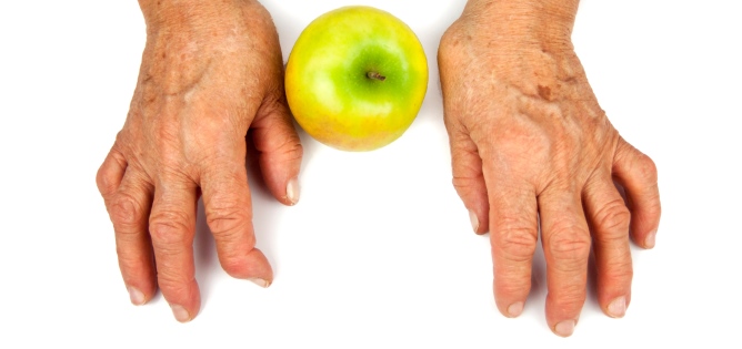 Rheumatoid Arthritis Diet