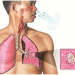 Multidrug Resistant TB