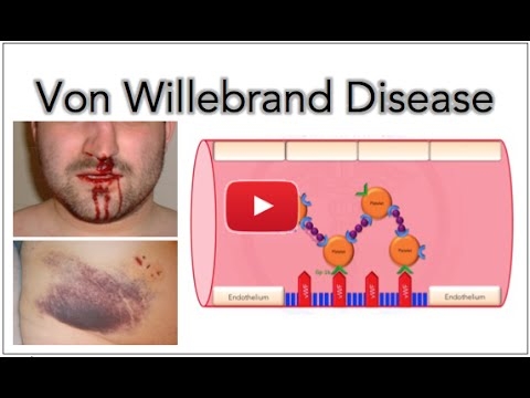 Von Willebrand disease