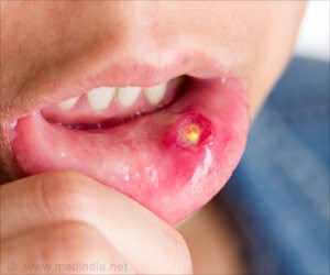 ORAL CANCER