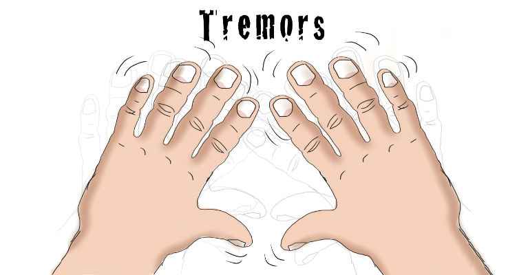 Tremor Causes, Symptoms, Diagnosis and Treatment - Natural Health News