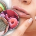 Acne Diet Plan for Teenager