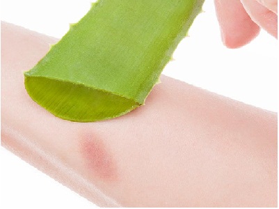 Aloe-Vera-Gels-For-Minor-Burns