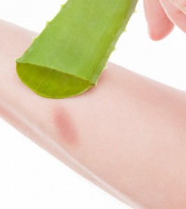 Aloe-Vera-Gels-For-Minor-Burns