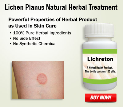 Lichen Planus Natural Herbal Treatment