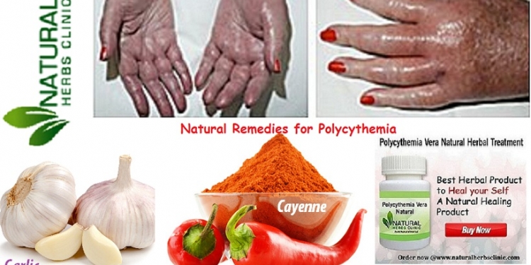 Natural Remedies for Polycythemia Vera