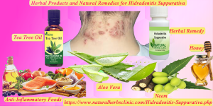 Natural Remedies For Hidradenitis Suppurativa