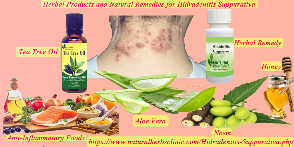 Natural Remedies for Hidradenitis Suppurativa