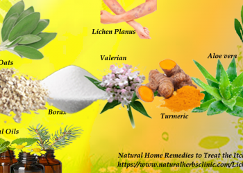 Natural Remedies for Lichen Planus