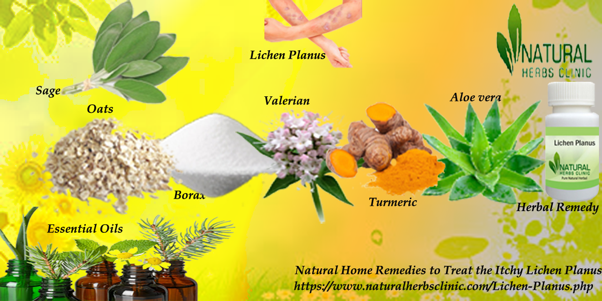 Natural Remedies for Lichen Planus