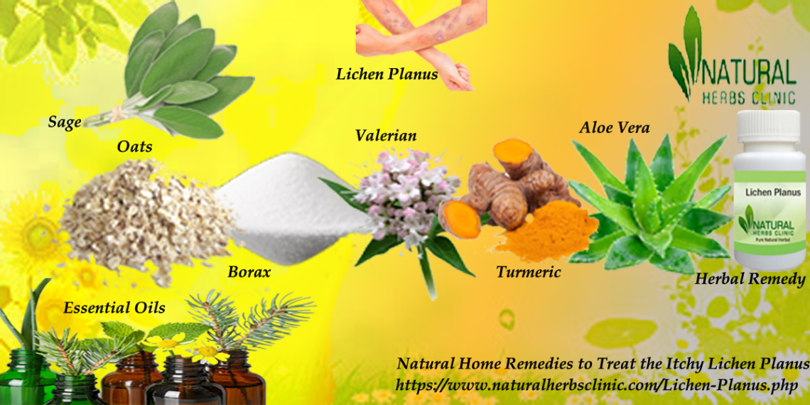 Natural Remedies for Lichen Planus