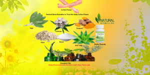 Natural Home Remedies to Treat the Itchy Lichen Planus