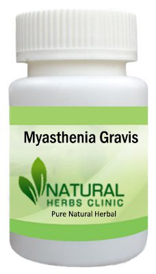 Myasthenia Gravis Herbal Treatment