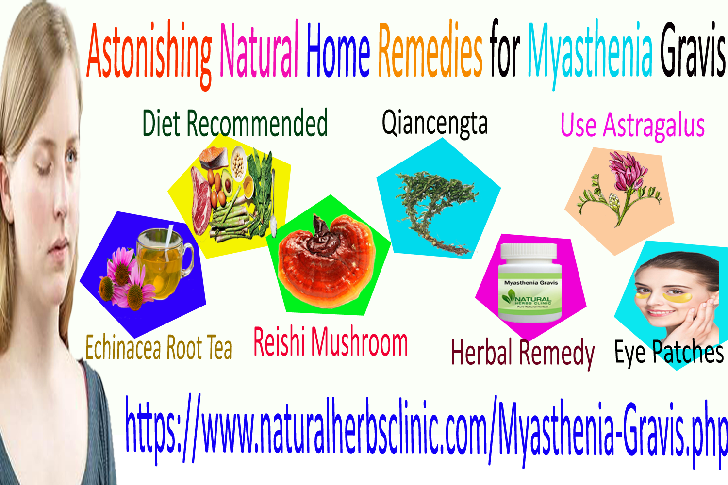 Natural Remedies for Myasthenia Gravis