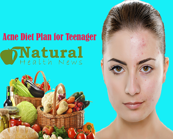 Acne Diet Plan for Teenager