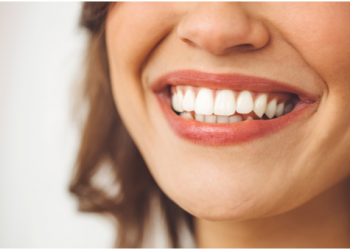 5 Life-Changing Teeth Whitening Benefits
