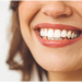 5 Life-Changing Teeth Whitening Benefits