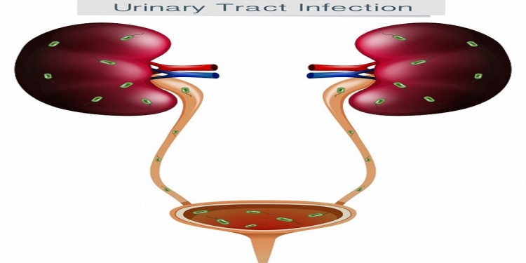 Bladder cancer