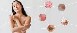 Tattoo Removal Cares-1