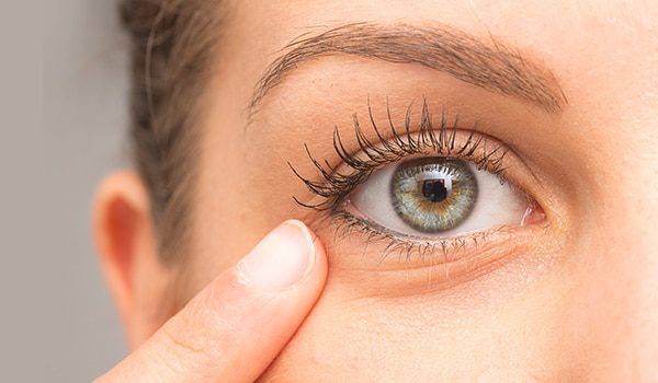 Homemade Remedies for Getting Rid of Eye bags