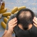 Top 4 Herbal Supplement for Alopecia Treatment
