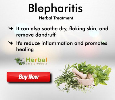 Herbal Treatment For Blepharitis