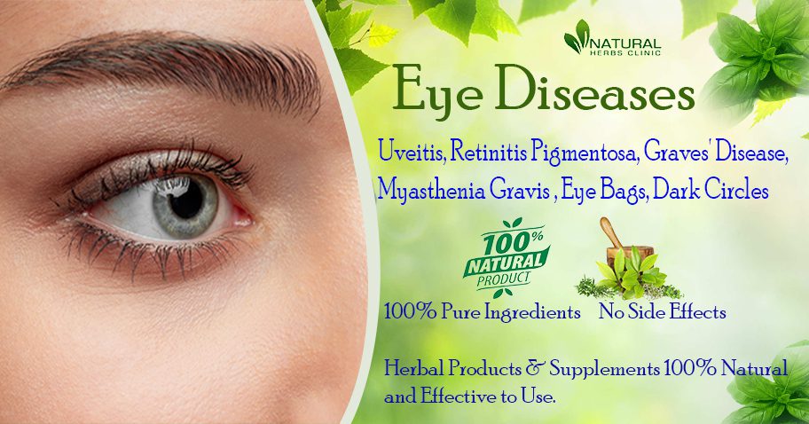 Herbal Supplements for Eye Disease