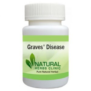 Natural Remedies for Graves' Disease