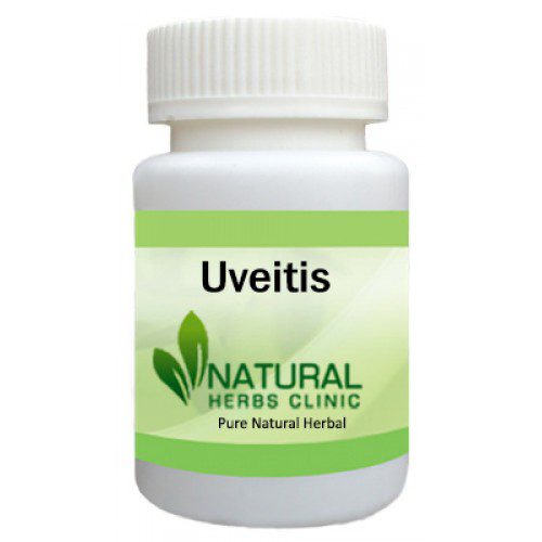 Herbal Supplements for Uveitis 