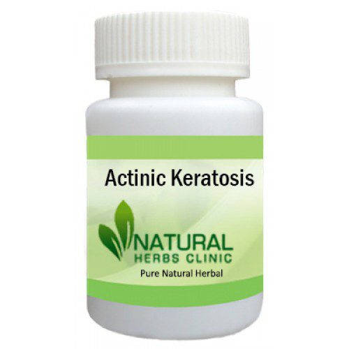 Natural Remedies for Actinic Keratosis