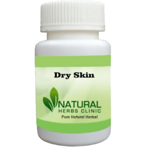 Natural Remedies for Dry Skin