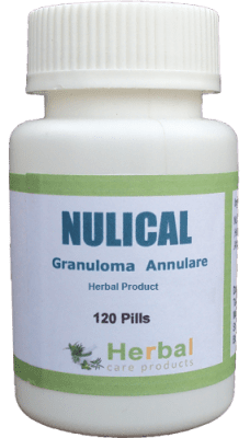 Granuloma-Annulare-Symptoms-Causes-and-Treatment-228x400