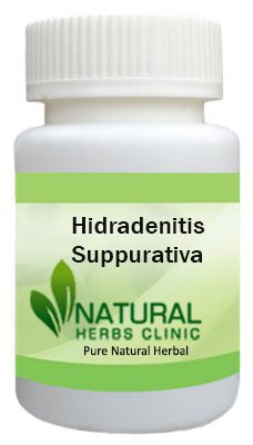 Hidradenitis Suppurativa Herbal Treatment
