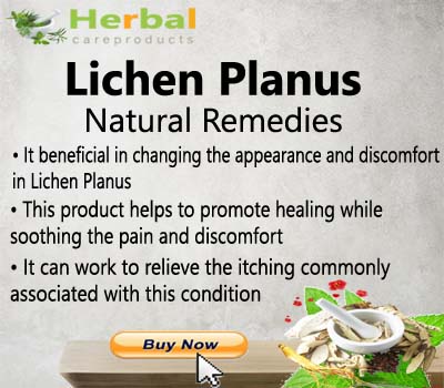 Herbal Supplement for Lichen Planus