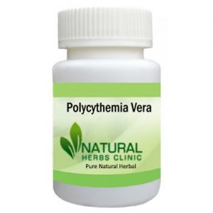 Natural Remedies for Polycythemia Vera