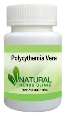 Polycythemia Vera Herbal Treatment
