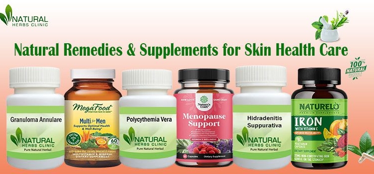 Natural Remedies for Skin Disease