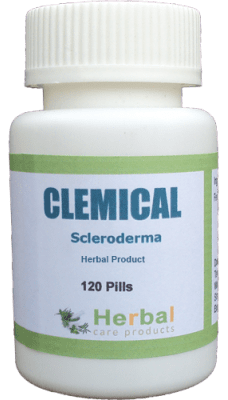 Scleroderma-Symptoms-Causes-and-Treatment-228x400