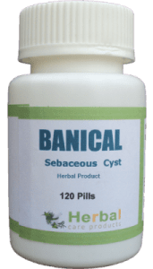 Sebaceous-Cyst-Symptoms-Causes-and-Treatment-228x400