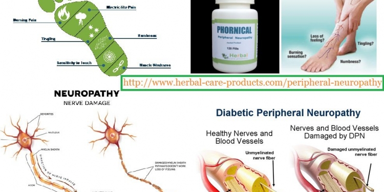 Herbal Supplement for Peripheral Neuropathy