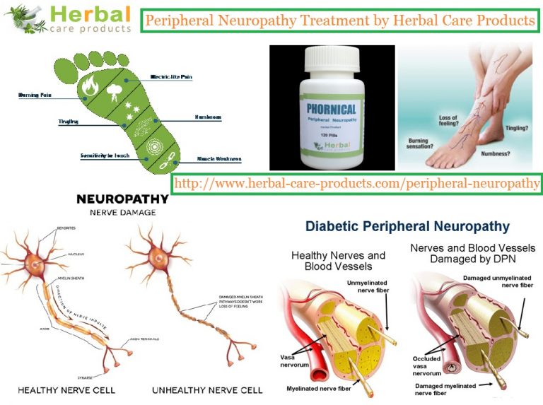 Natural Treatments for Peripheral Neuropathy in Your body Natural