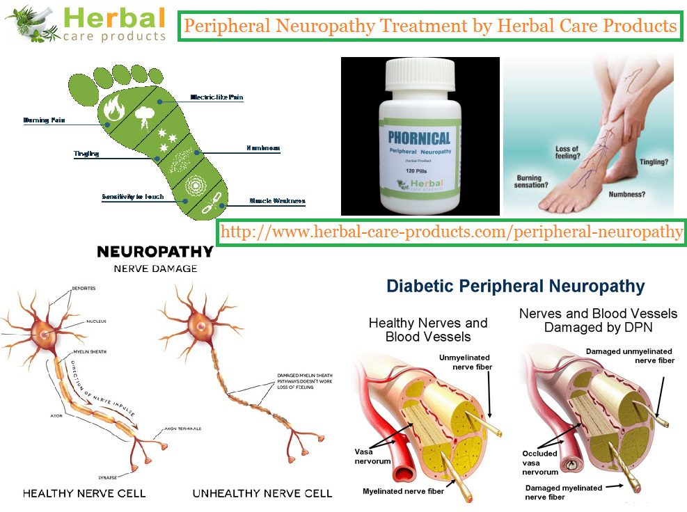 Herbal Supplement for Peripheral Neuropathy