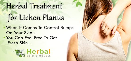 Herbal Treatment for Lichen Planus