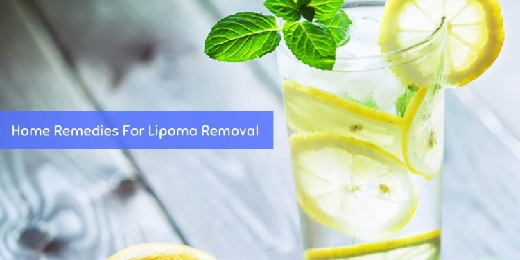 Home Treatment for Lipoma - Lipoma Natural Supplement