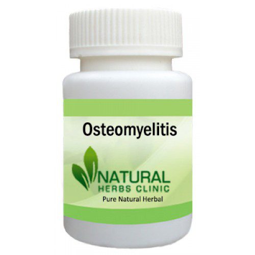 Herbal Supplements For Osteomyelitis
