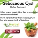 Herbal Supplement for Sebaceous Cyst
