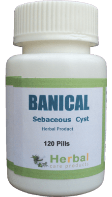 Herbal Supplement for Sebaceous Cyst