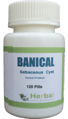 Sebaceous-Cyst-Symptoms-Causes-and-Treatment-228x400