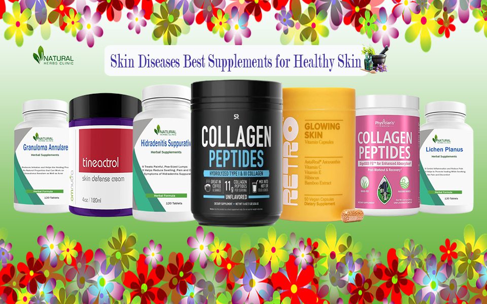 Herbal Supplements for Skin Diseases